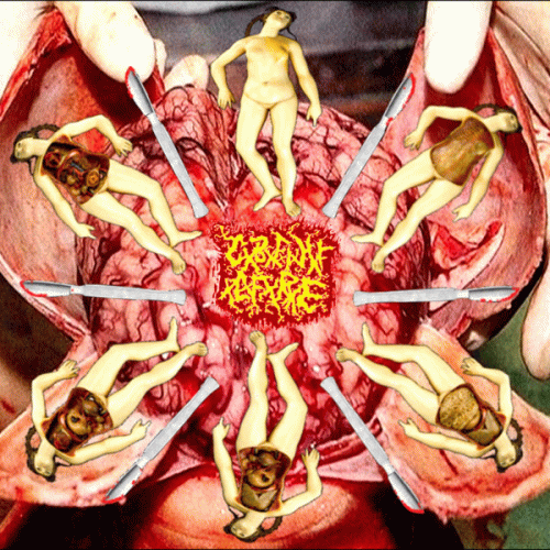 Catastrophic Blunt Force Intracranial Haemorrhage Fluid Leaking From Ruptured Eardrums : Puncture And Aspiration Of The Internal Organs To Forestall Decposition